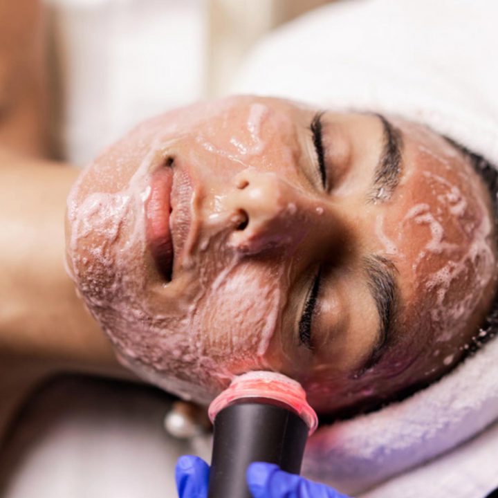 Woman undergoing Oxygeneo Facial Treatment
